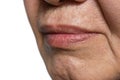 Skin folds and creases in face