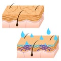Skin hydration sectional view. Royalty Free Stock Photo