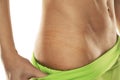 Skin indents from underwear on a woman`s hips. closeup Royalty Free Stock Photo