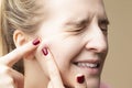 Skin Issues. Portrait of Young Emotional Caucasian Blond Woman With Skin Problems Squeezing Pustules By Fingers Against Beige