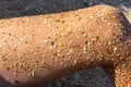 The skin on the leg of a young girl or young man sunbathing on a sea beach in pieces of seashells and sand. Royalty Free Stock Photo