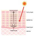 Skin mechanism of blotches
