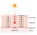 Skin mechanism of blotches