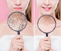 Skin moisturizing care concept