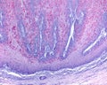 Skin. Molluscum contagiosum