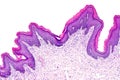 Skin papilloma of a human