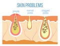 Skin pores close up Royalty Free Stock Photo