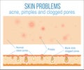 Skin and pores Royalty Free Stock Photo