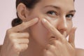 Skin Problem. Depressed Woman Touching Pimple On Her Face Royalty Free Stock Photo