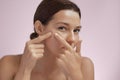 Skin Problem. Depressed Woman Touching Pimple On Her Face Royalty Free Stock Photo