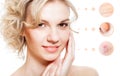 Skin problem of woman face Royalty Free Stock Photo