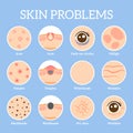 Skin problems. Ages wrinkles problem, face skin infection treatment and dark circles under eyes vector icons set