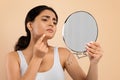 Skin Problems. Indian Woman Holding Mirror And Looking At Pimple On Chin Royalty Free Stock Photo