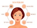 Skin problems. Infographics. Vector. Royalty Free Stock Photo