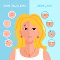 Skin problems solution. Home skincare treatment procedures, teenager face with psoriasis problem skinspot facial Royalty Free Stock Photo