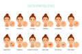 Skin problems vector