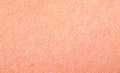 Skin texture Royalty Free Stock Photo