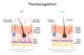 Skin in thermoregulation. Body temperature regulation Royalty Free Stock Photo