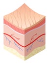 Skincare medical concept. Problems in cross-section of human skin horizontal layers structure. Anatomy illustrative Royalty Free Stock Photo