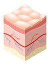 Skincare medical concept. Problems in cross-section of human skin horizontal layers structure. Anatomy illustrative Royalty Free Stock Photo