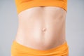 Skinny belly after tummy tuck, plastic surgery concept