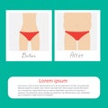 From skinny to fat woman infographic. Before after instant photo. Flat design