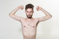 Skinny young man flex arms. Slim man do sport training. Stimulating muscle growth with anabolic steroids. Man increases Royalty Free Stock Photo