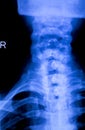 Skull neck spine xray scan