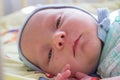 Sleepy baby lies,newborn infant with acne on face