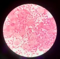 Slide show Gram negative diplococci in pus from penis