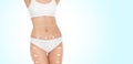 Slim woman with marks on body for cosmetic surgery operation against light background, closeup. Banner design Royalty Free Stock Photo