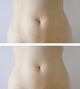 Slimming : before-after Royalty Free Stock Photo