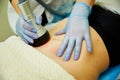 Slimming and cellulite laser treatment at clinic