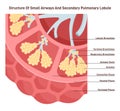 Small airways and secondary pulmonary lobule structure. Alveoli, bronchiole