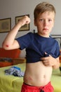 Small boy with wounded skin on the arm