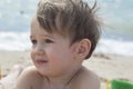 Small child with redness on the skin, suffering from allergies Royalty Free Stock Photo