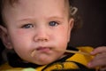 Small child with redness on the skin, suffering from food allergies. Royalty Free Stock Photo