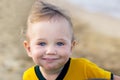 Small child with redness on the skin, suffering from food allergies. Royalty Free Stock Photo