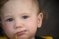 Small child with redness on the skin Royalty Free Stock Photo