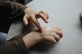 A small child smears redness on the hand with baby cream. The concept of treatment and skin care with cream, frostbite Royalty Free Stock Photo