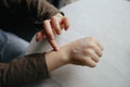 A small child smears redness on the hand with baby cream. The concept of treatment and skin care with cream, frostbite Royalty Free Stock Photo