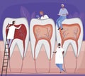 Small dentists and orthodontists around a big tooth or teeth as a treatment concept in a dental clinic, flat vector stock