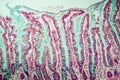 Small intestine with villi under the microscope