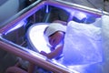 The baby lies under an ultraviolet lamp with jaundice Royalty Free Stock Photo