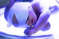 The baby lies under an ultraviolet lamp with jaundice Royalty Free Stock Photo