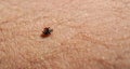 Small tick Ixodes ricinus crawling on human skin