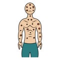 Smallpox on the human body. Color vector illustration. The face and body of the patient is covered with spots.