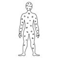 Smallpox on the human body. Sketch. Vector illustration. The patient`s face and body are covered with spots.