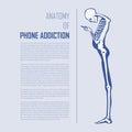 Smartphone Addiction Infographics in flat design. Human bone anatomy.