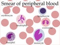 Smear of peripheral blood Royalty Free Stock Photo